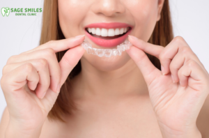 Invisalign aligners in Calgary NW