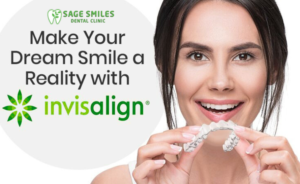 Invisalign aligners in Calgary NW at Sage Smiles Dental Clinic for a straight, confident, and beautiful smile.