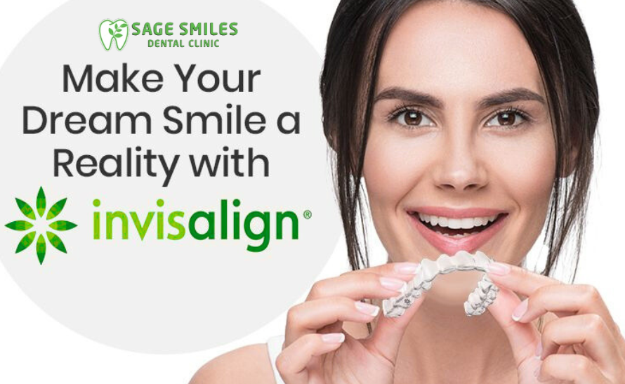 Invisalign aligners in Calgary NW at Sage Smiles Dental Clinic for a straight, confident, and beautiful smile.